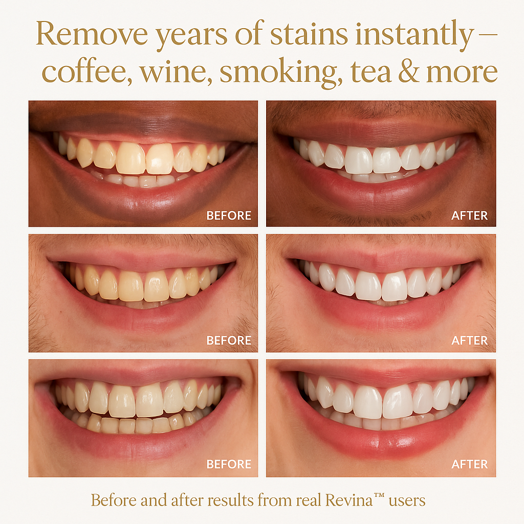 Revina™ Luxe Whitening Pen